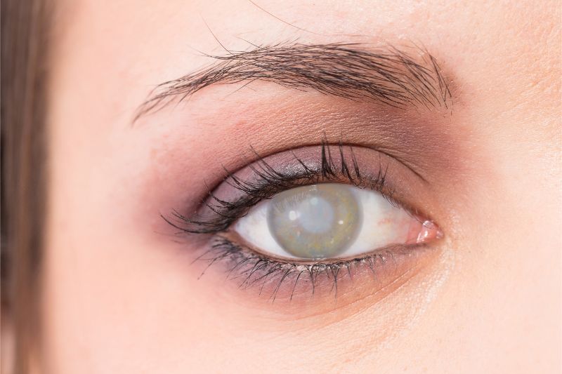 Reduce your risk of cataracts, with Irispro window tint. Enjoy the sun, protect your eyes.